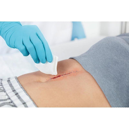 Leukoplast, comprese sterile din bumbac, Röko – în utilizare